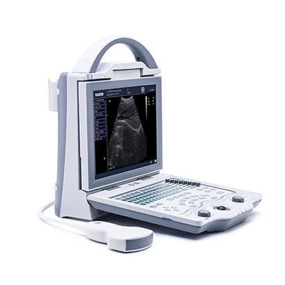Portable ultrasound system KX5600 alternate view image 2