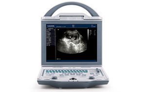 Portable ultrasound system KX5600 image 3
