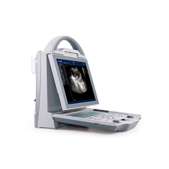Portable ultrasound system KX5600