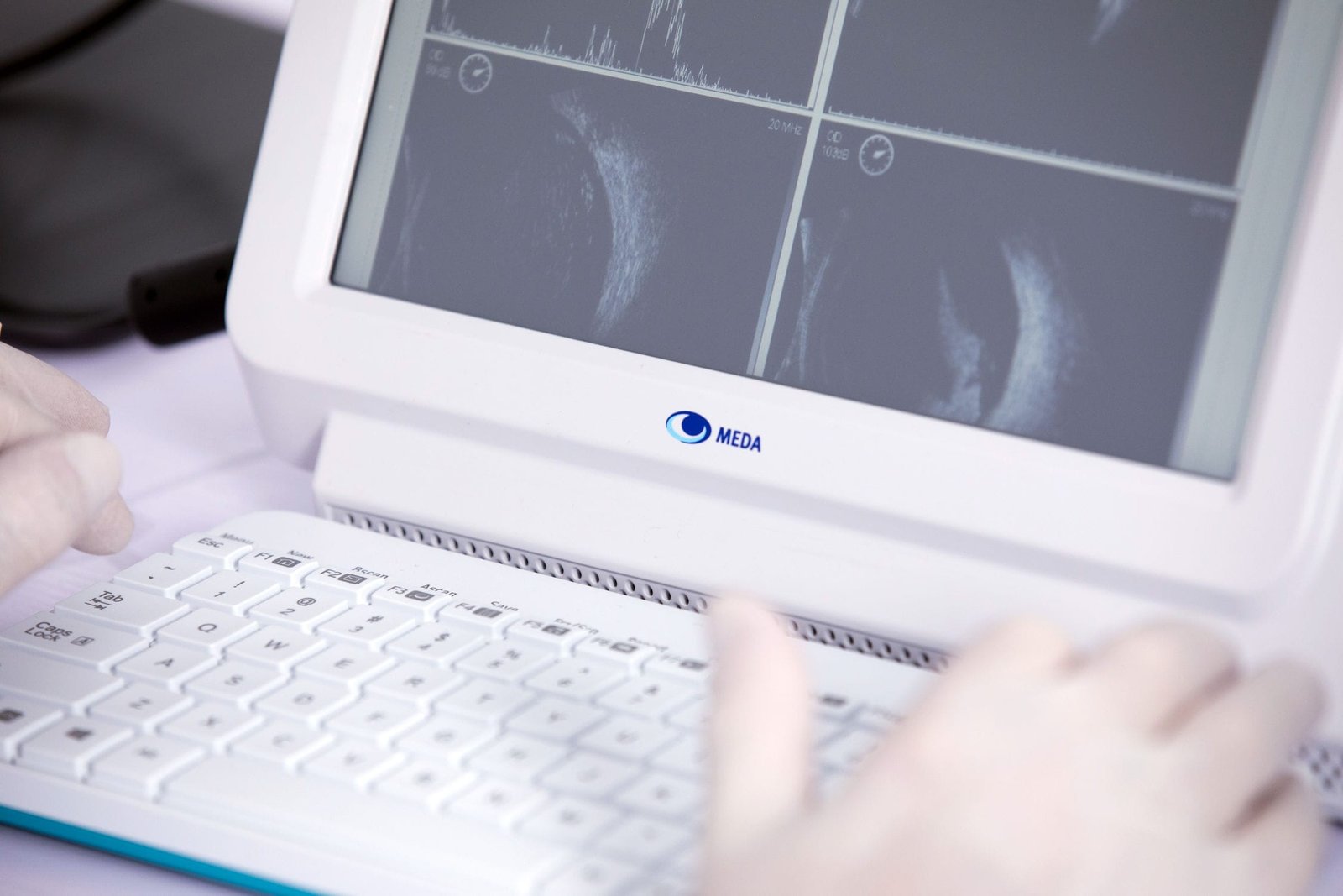 Portable ultrasound system MD-2300S image 4