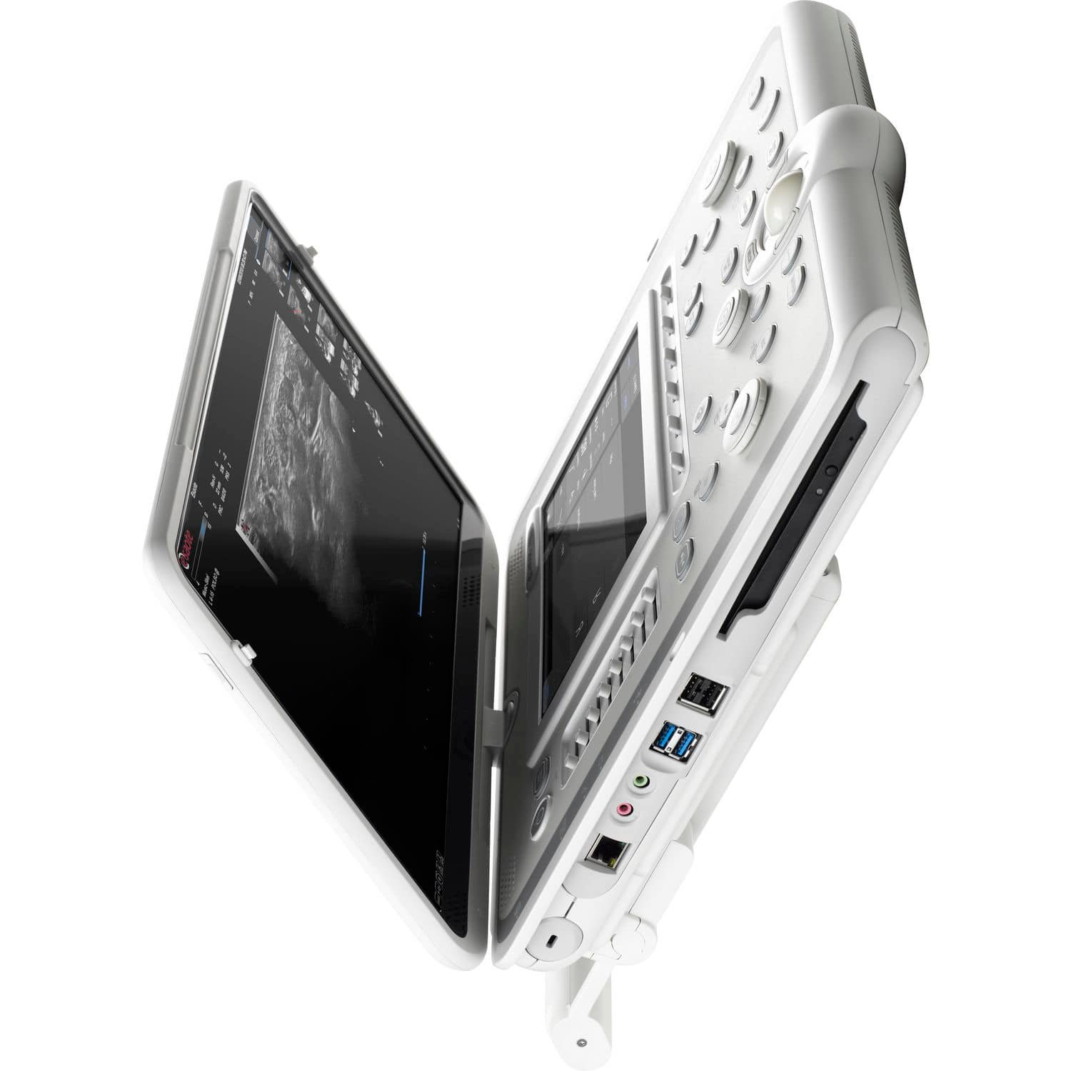 Portable ultrasound system MyLab™Omega alternate view image 2