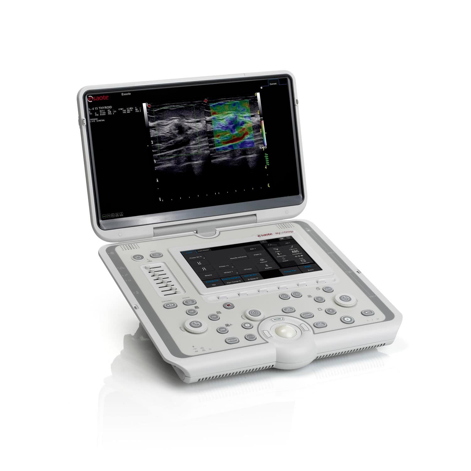 Portable ultrasound system MyLab™Omega