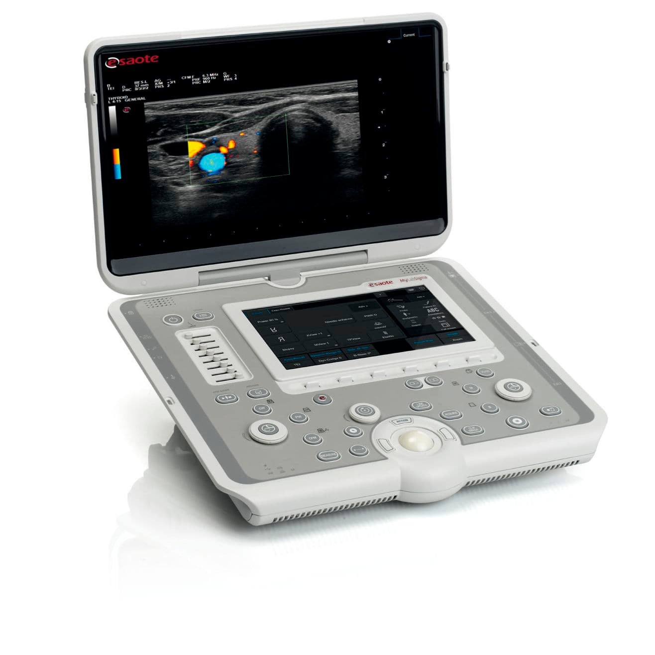 Portable ultrasound system MyLab™Sigma