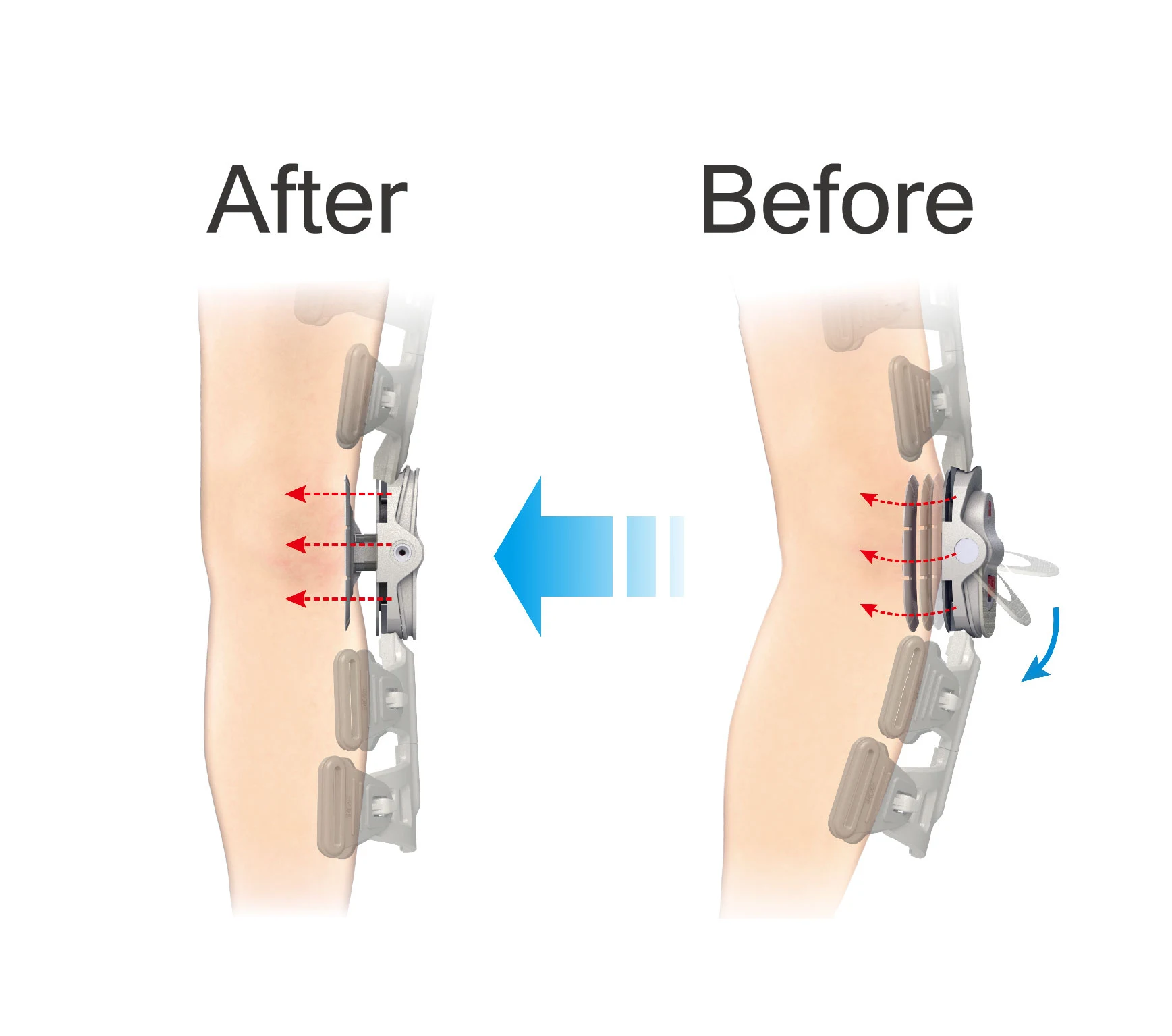 PUSH-POWER OA KNEE BRACE (STANDARD) Right 57320 image 5