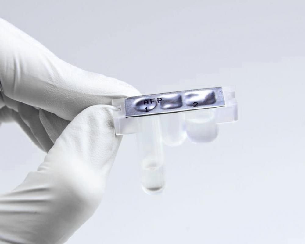 Research test kit Lumipulse® image 4