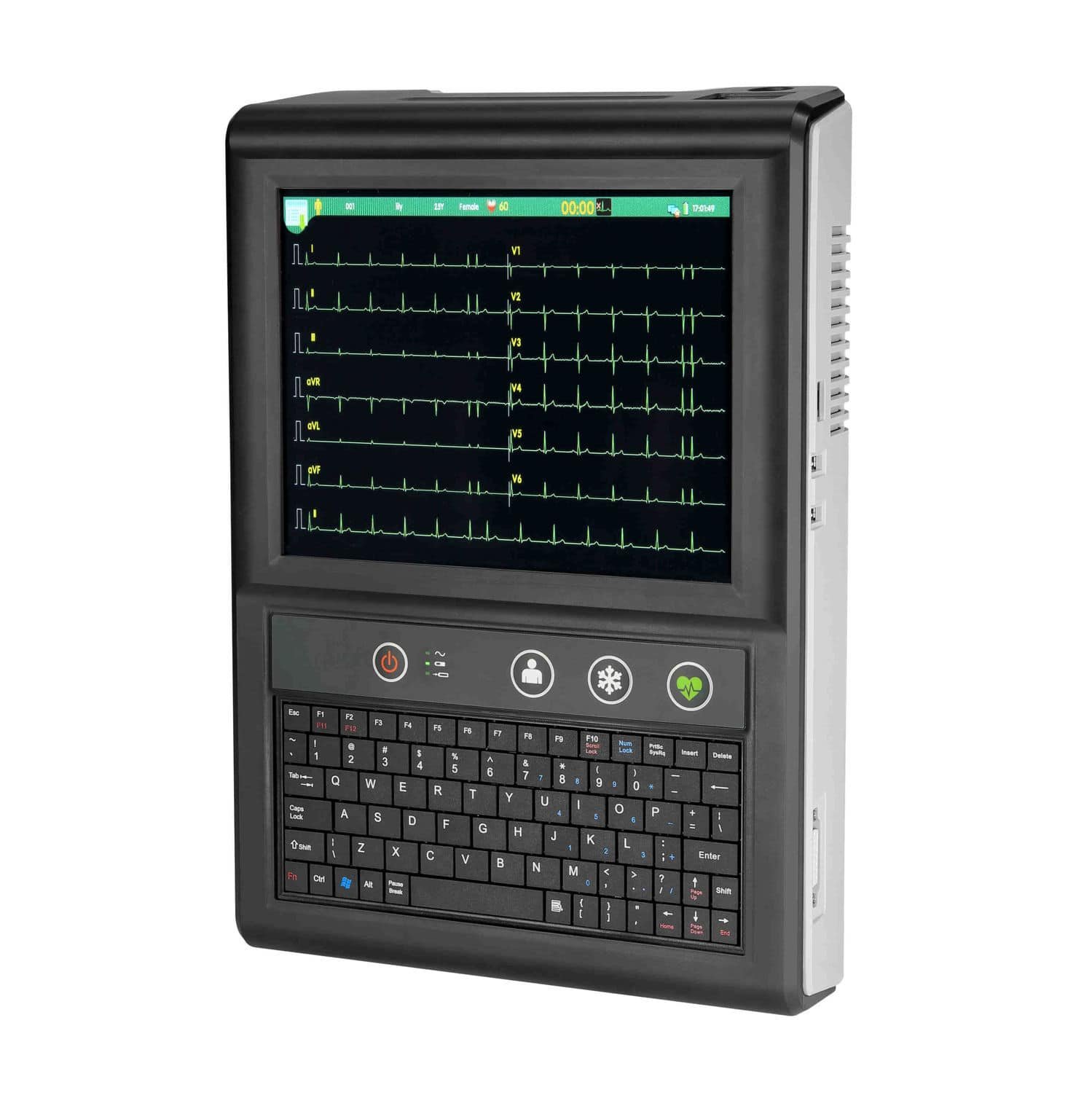 Resting electrocardiograph T12B alternate view image 2