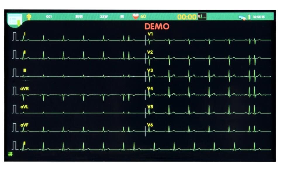 Resting electrocardiograph T12B image 3