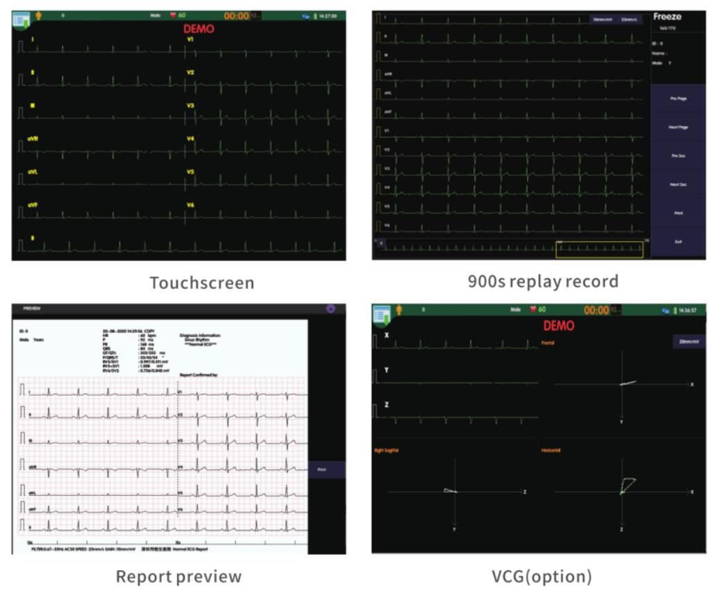 Resting electrocardiograph T12B image 7