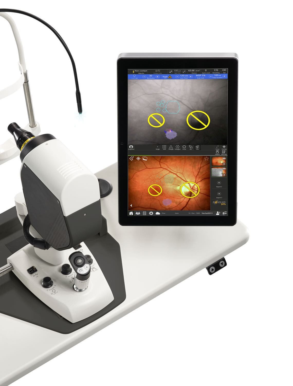 Retinal photocoagulation laser Navilas® 577s image 5
