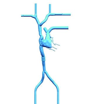 Sinus vascular model PLXG1011 image 3