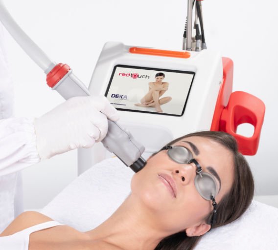 Skin rejuvenation laser RedTouch image 4
