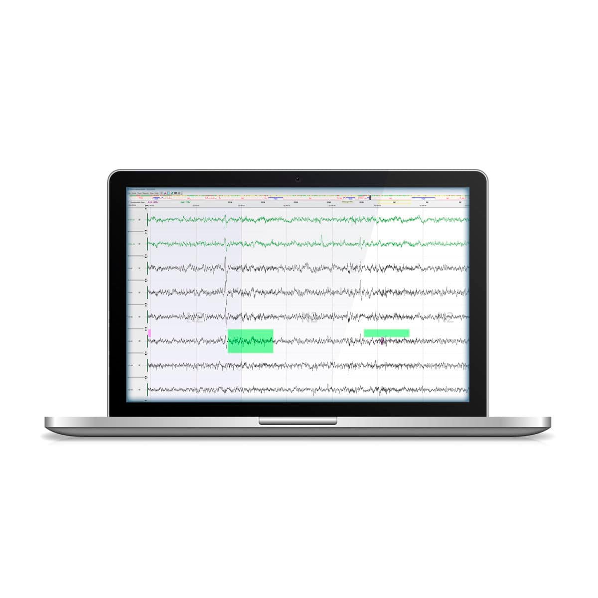 Sleep laboratory software DOMINO image 4