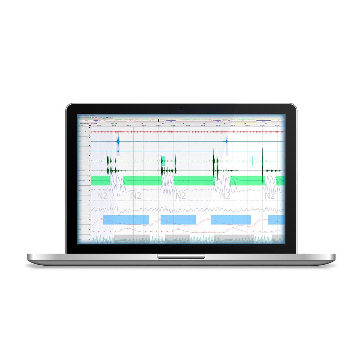 Sleep laboratory software DOMINO image 5