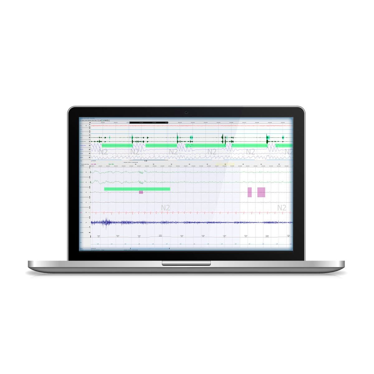 Sleep laboratory software DOMINO image 7