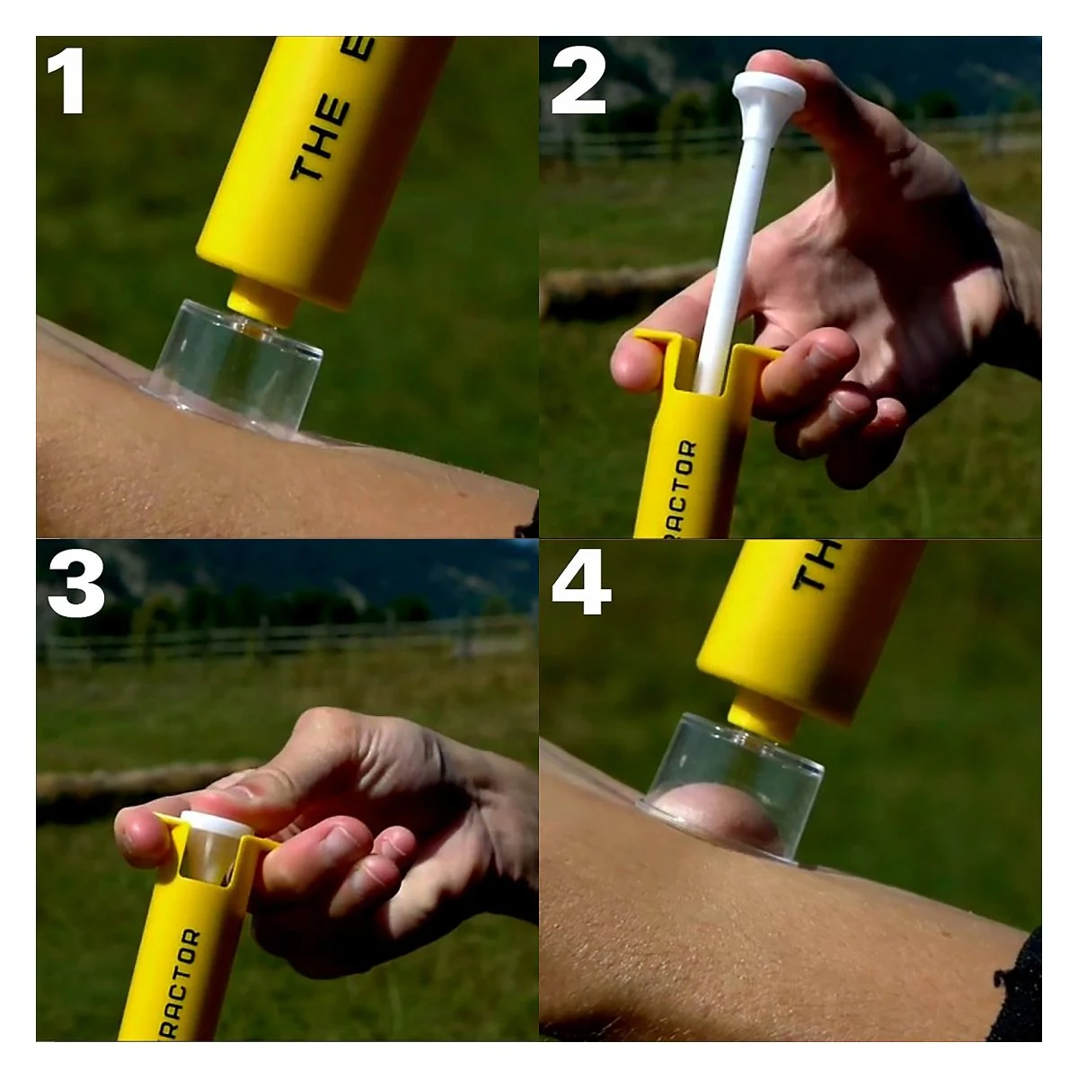 Snake Bite and Sting Kit with Pump image 2