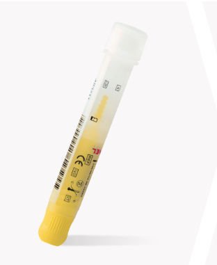 Solution reagent kit CALiaGold® image 4