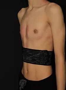 Thoracic support belt Rib Flare image 2