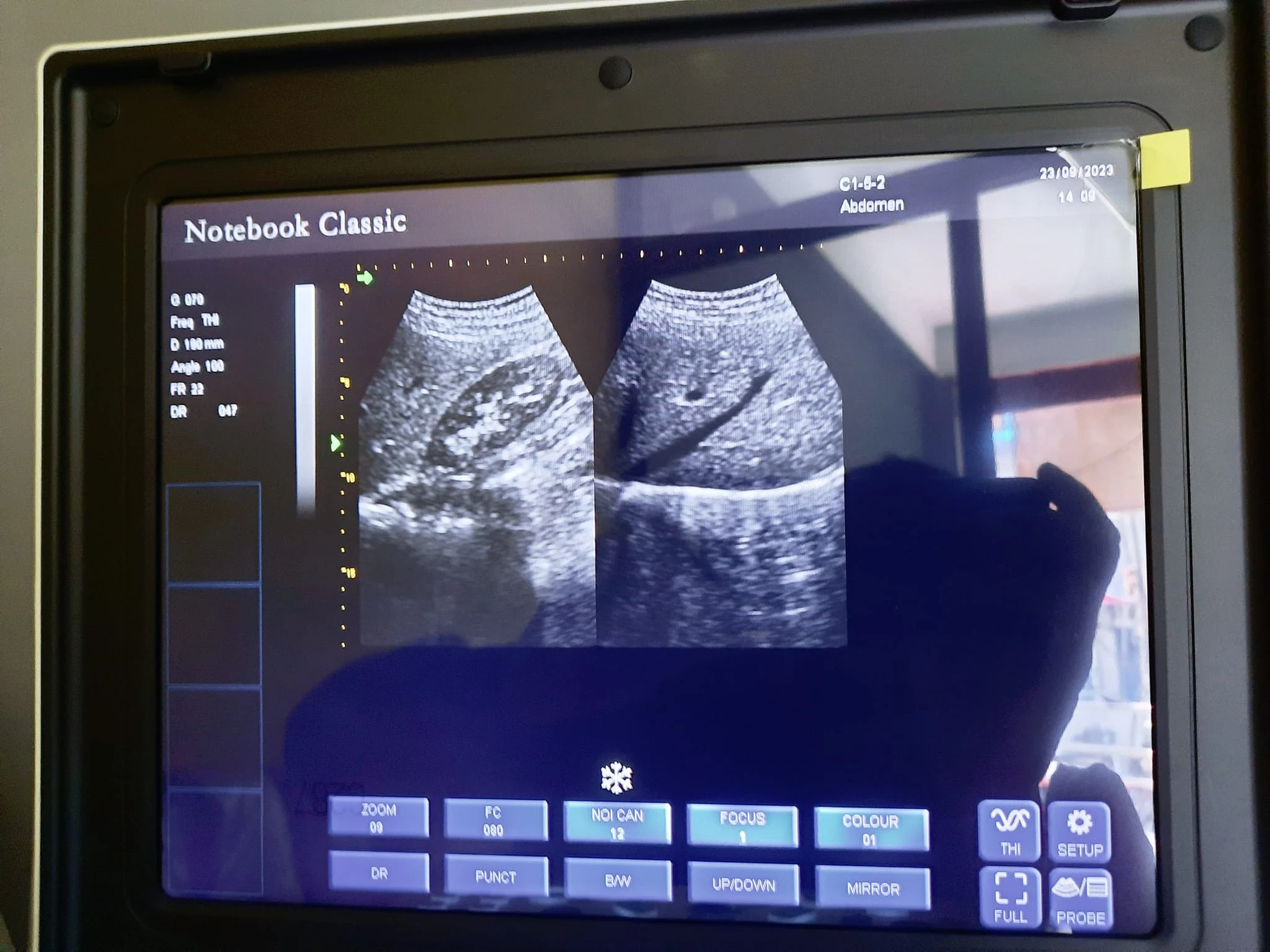 Ultrasound Machine Laptop Oriel Notebook Classic image 3