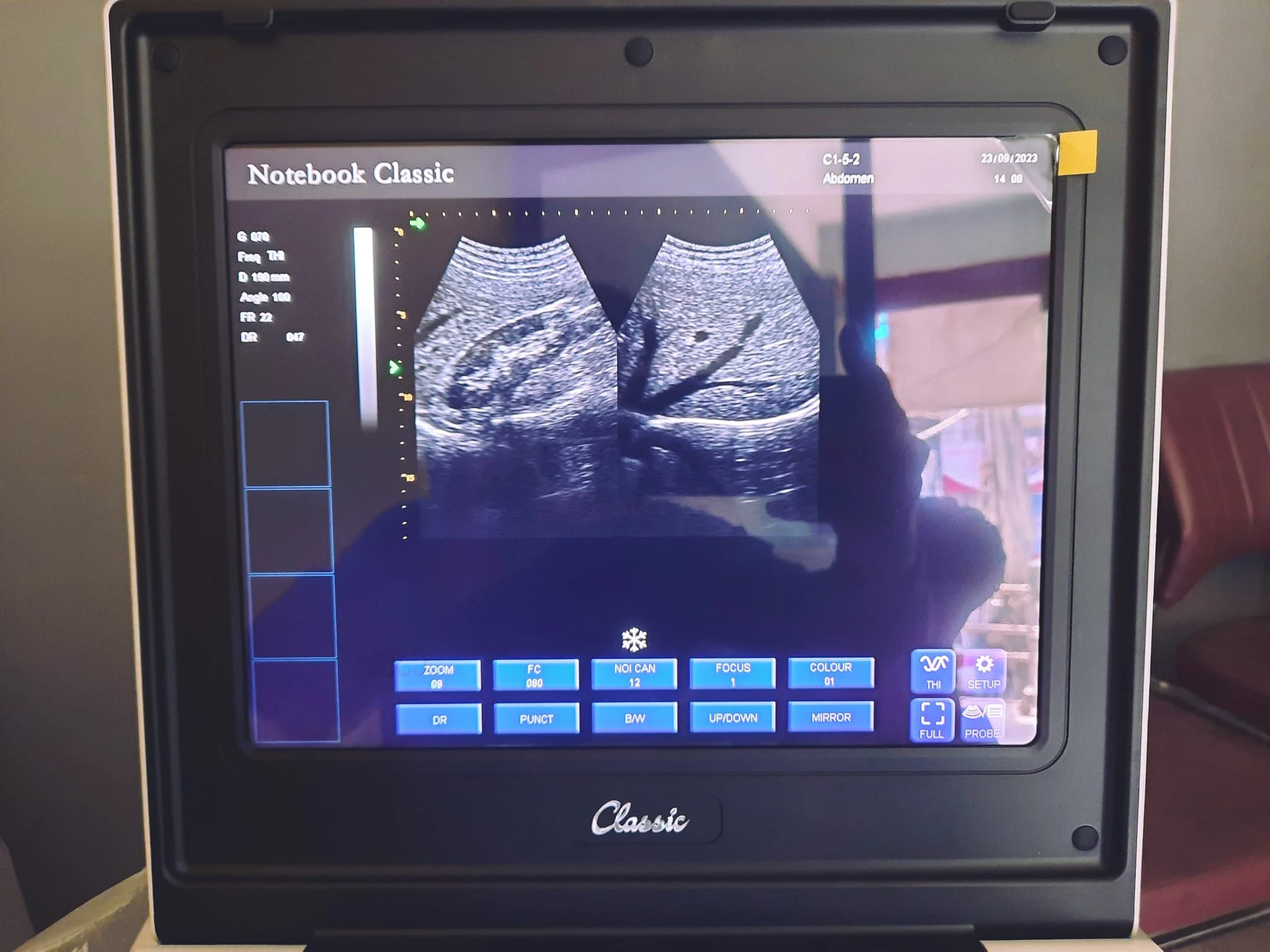 Ultrasound Machine Laptop Oriel Notebook Classic image 4