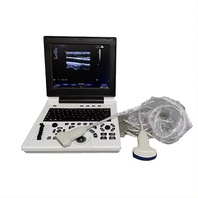 Ultrasound Machine Laptop Ultrasonic Diagnostic System Portable image 3