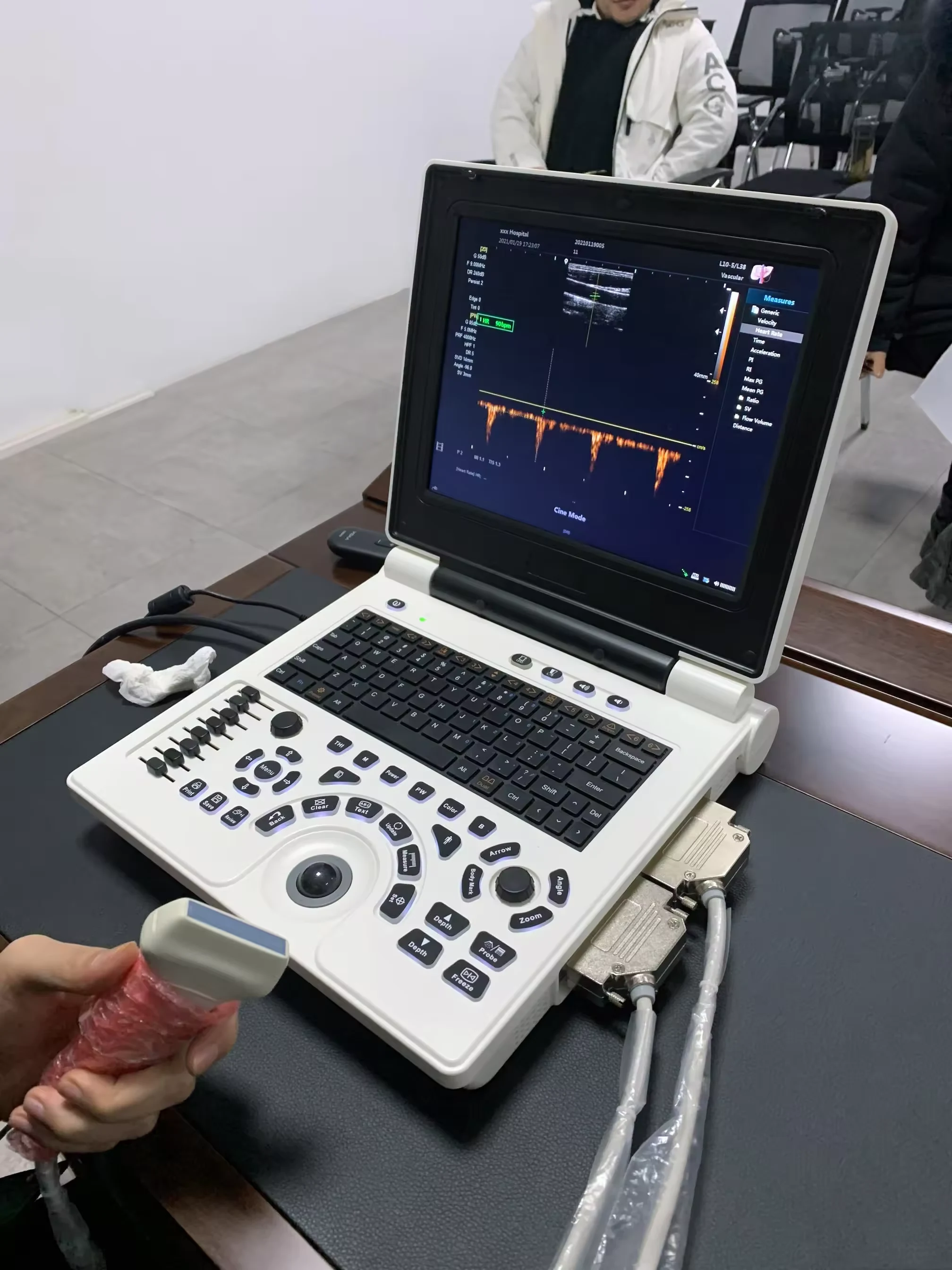 Ultrasound Machine Laptop Ultrasonic Diagnostic System Portable image 4