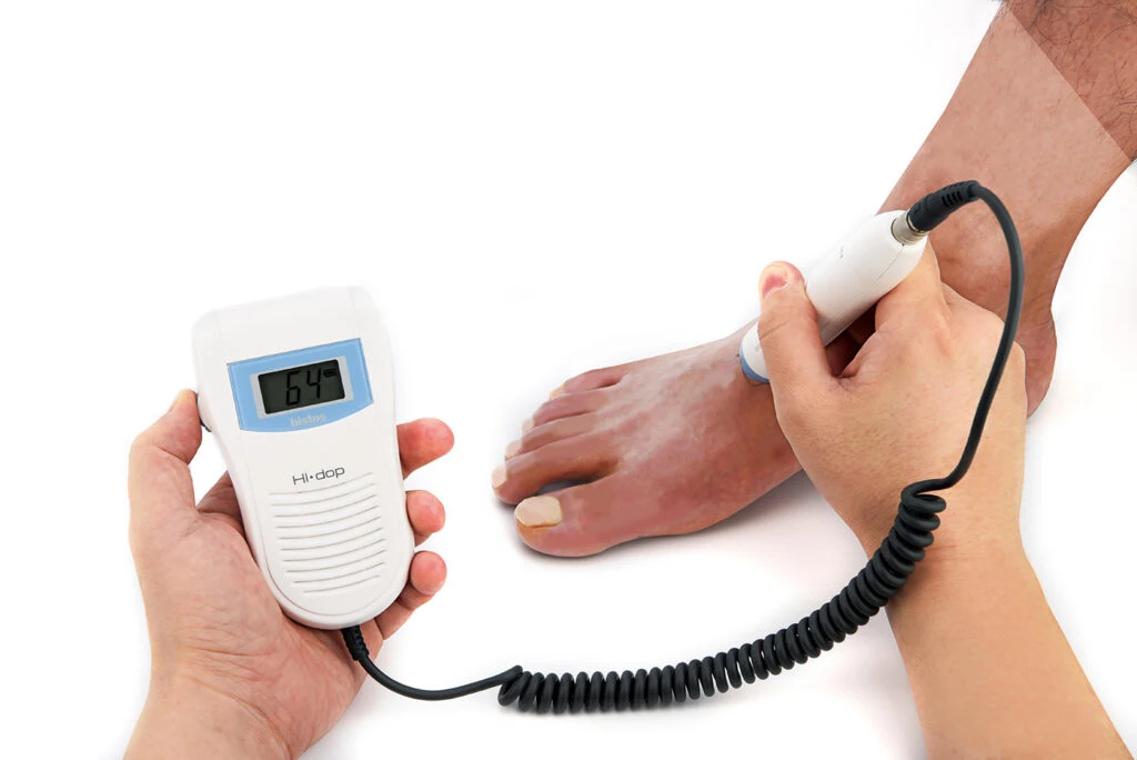 Vascular Doppler Bistos Bt200v image 4