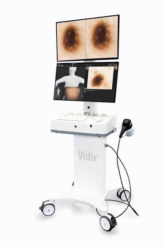 Video dermatoscope VIDIX 4.0