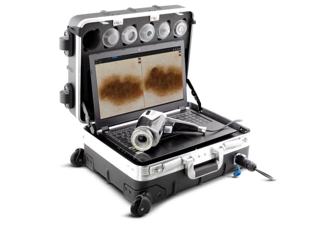 Video dermatoscope VIDIX