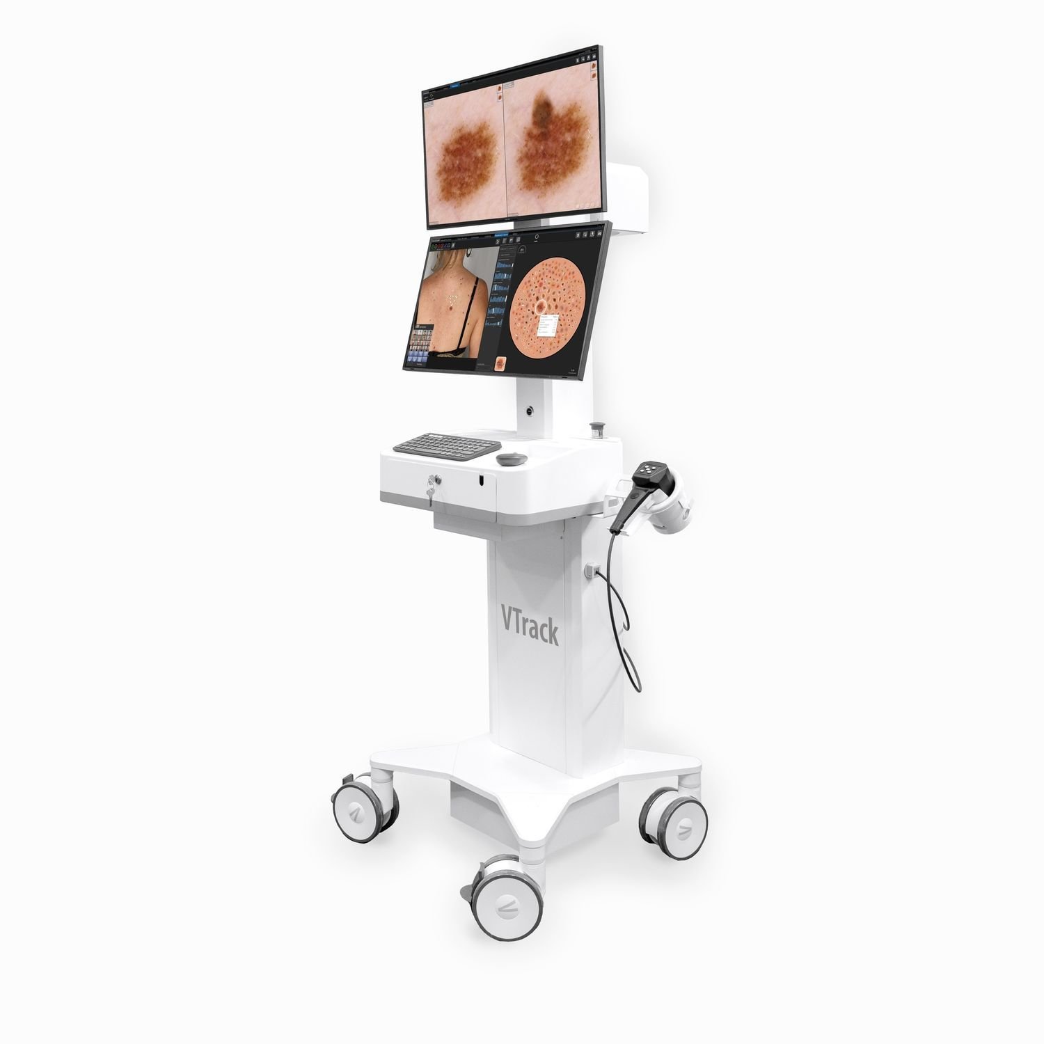 Video dermatoscope VTRACK 4.0