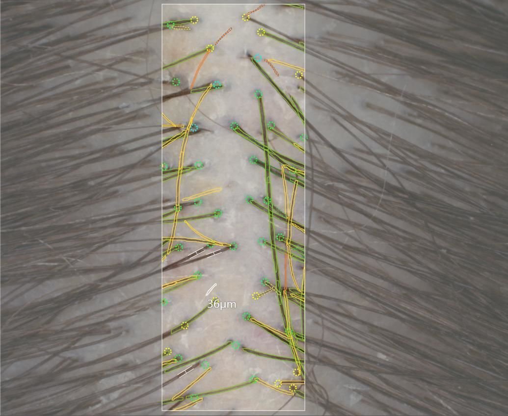 Video trichoscope Tricho-One image 2