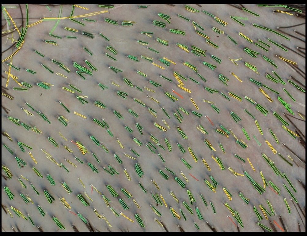 Video trichoscope Tricho-One image 3