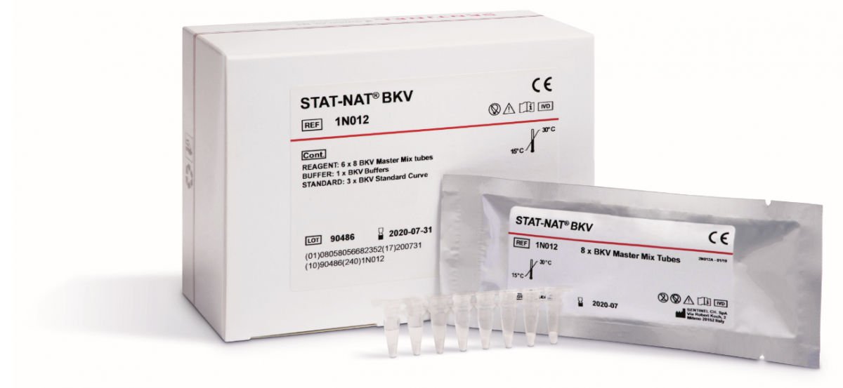 Virus reagent kit STAT-NAT® BKV