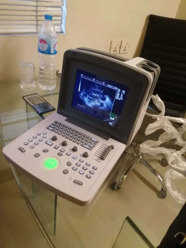 WED 9618 Digital Ultrasound Portable Machine image 3