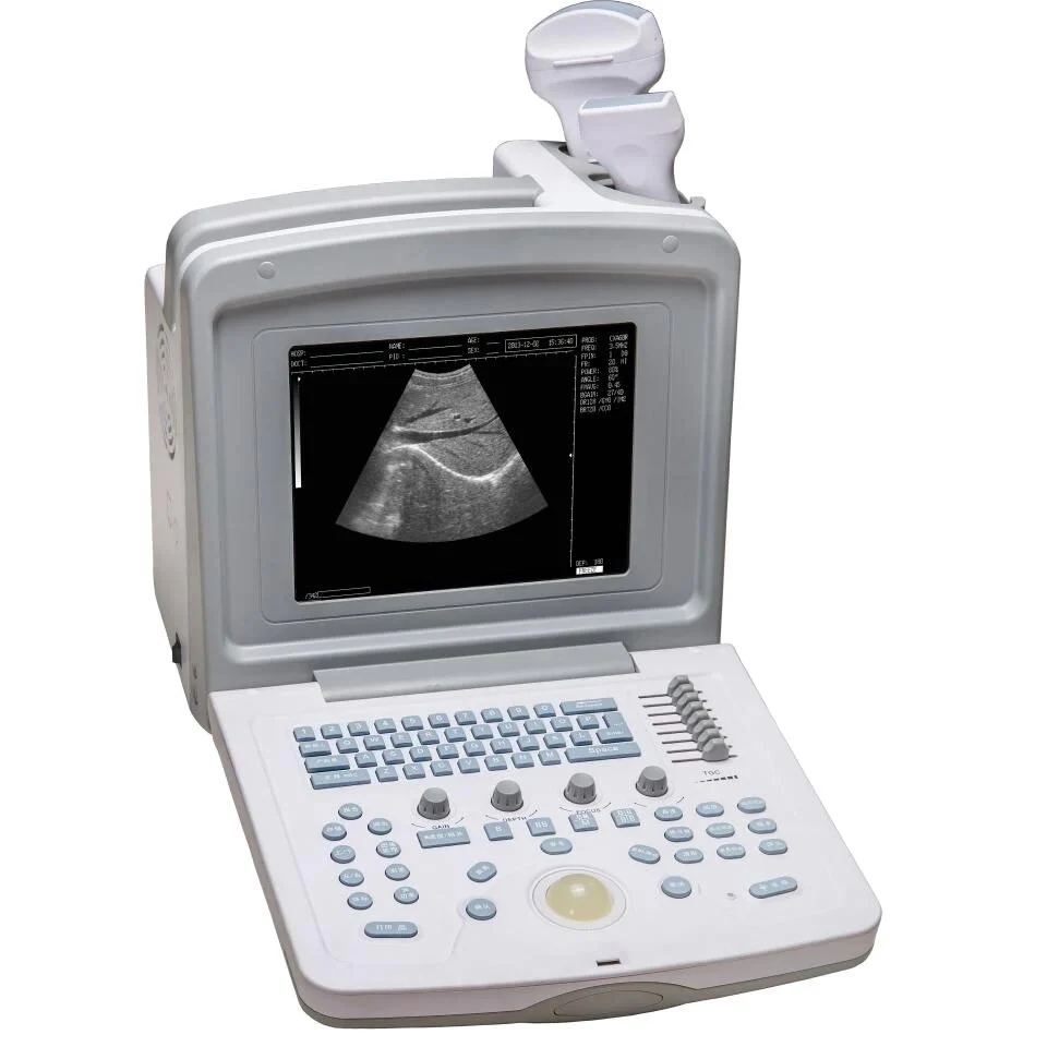WED 9618 Digital Ultrasound Portable Machine image 4